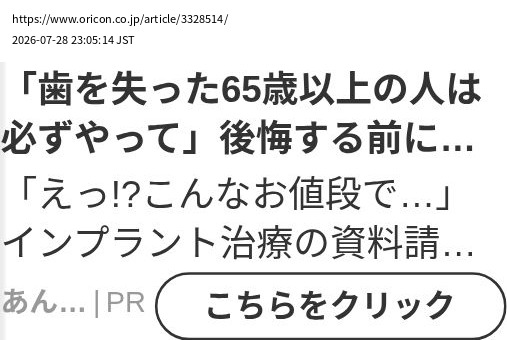 element capture