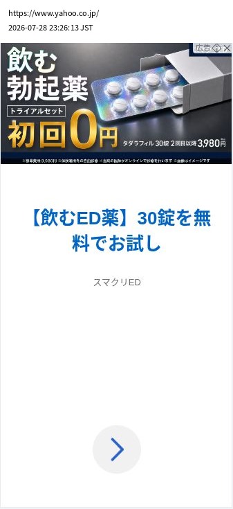 element capture